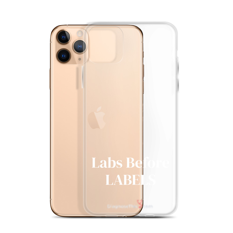 iPhone®  Labs before labels. 